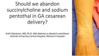Should we abandon
succinylcholine and sodium
pentothal in GA cesarean
delivery?
Antti Väänänen, MD, Ph.D. SSAI diploma in obstetric anesthesia
Helsinki University Central Hospital /Women’s hospital
 