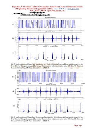 Priya Rani, A N Cheeran, Vaibhav D Awandekar, Rameshwari S Mane / International Journal
     of Engineering Research and Applications (IJERA) ISSN: 2248-9622 www.ijera.com
                        Vol. 3, Issue 2, March -April 2013, pp.311-316
      6 la
      0i t
      *g
       SR
       a e
       m
       pn
e
H
a
r
t
Ra
 t
 e
  2 atAtf s
   *t a g iP
   Dc .r e
   en v a a
   c F Sn
    io * e
    mi oe o
       r p ok




Fig 3: Implementation of Heart Rate Monitoring of a Child (a) Original recorded heart sound signal, (b) 5th
level detail of the signal calculated by wavelet decomposition and reconstruction using dB6 (level 5) filter, (c)
Square of filtered signal & Peaks detected for S1 & S2 both.




Fig 4: Implementation of Heart Rate Monitoring of an Adult (a) Original recorded heart sound signal, (b) 5th
level detail of the signal calculated by wavelet decomposition and reconstruction using dB6 (level 5) filter, (c)
Square of filtered signal & Peaks detected for S1 & S2 both.

                                                                                                  314 | P a g e
 