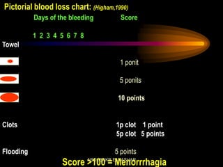 Pictorial blood loss chart: (Higham,1990)
Days of the bleeding Score
1 2 3 4 5 6 7 8
Towel
1 ponit
5 ponits
10 points
Clots 1p clot 1 point
5p clot 5 points
Flooding 5 points
Score >100 = MenorrrhagiaABOUBAKR ELNASHAR
 