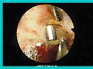 ABOUBAKR ELNASHAR
 