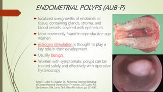 ENDOMETRIAL POLYPS (AUB-P)
 localized overgrowths of endometrial
tissue, containing glands, stroma, and
blood vessels, covered with epithelium.
 Most commonly found in reproductive-age
women
 estrogen stimulation is thought to play a
key role in their development.
 Usually benign.
 Women with symptomatic polyps can be
treated safely and effectively with operative
hysteroscopy
Ryntz T, Lobo R. Chapter 26. Abnormal Uterine Bleeding;
In Comprehensive Gynecology 7th edition, 2017;Lobo RA,
Gershenson DM, Lentz GM, Valea FA editors; pp 621-633.
 