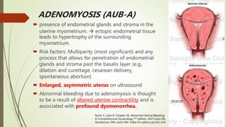 ADENOMYOSIS (AUB-A)
 presence of endometrial glands and stroma in the
uterine myometrium.  ectopic endometrial tissue
leads to hypertrophy of the surrounding
myometrium.
 Risk factors: Multiparity (most significant) and any
process that allows for penetration of endometrial
glands and stroma past the basalis layer (e.g.,
dilation and curettage, cesarean delivery,
spontaneous abortion)
 Enlarged, asymmetric uterus on ultrasound
 Abnormal bleeding due to adenomyosis is thought
to be a result of altered uterine contractility and is
associated with profound dysmenorrhea.
Ryntz T, Lobo R. Chapter 26. Abnormal Uterine Bleeding;
In Comprehensive Gynecology 7th edition, 2017;Lobo RA,
Gershenson DM, Lentz GM, Valea FA editors; pp 621-633.
 