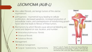 LEIOMYOMA (AUB-L)
 Also called fibroids, are benign tumors of the uterine
myometrium.
 pathogenesis : myometrial injury leading to cellular
proliferation, decreased apoptosis, increased production of
extracellular matrix, and overexpression of transforming growth
factor beta that leads to fibrosis of these tumors.
 Mechanisms by which fibroids cause abnormal bleeding are
varied and depend on size, location, and number:
 Intracavitary/submucous fibroids
 intramural fibroids
 Subserous fibroids
 Management:
 Medical management
 Surgical : hysterectomy, myomectomy
Ryntz T, Lobo R. Chapter 26. Abnormal Uterine Bleeding;
In Comprehensive Gynecology 7th edition, 2017;Lobo RA,
Gershenson DM, Lentz GM, Valea FA editors; pp 621-633.
 
