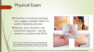 Physical Exam
Petechiae or excessive bruising:
may suggest a platelet defect or
another bleeding disorder.
Obesity, acne, hirsutism, and
acanthosis nigricans : may be
present in a patient with PCOS.
Ryntz T, Lobo R. Chapter 26. Abnormal Uterine Bleeding;
In Comprehensive Gynecology 7th edition, 2017;Lobo RA,
Gershenson DM, Lentz GM, Valea FA editors; pp 621-633.
Rydz N and Jamieson MA. Managing heavy menstrual bleeding in adolescents. 2013. http://contemporaryobgyn.modernmedicine.com/
 