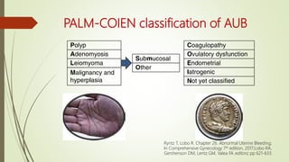 PALM-COIEN classification of AUB
Ryntz T, Lobo R. Chapter 26. Abnormal Uterine Bleeding;
In Comprehensive Gynecology 7th edition, 2017;Lobo RA,
Gershenson DM, Lentz GM, Valea FA editors; pp 621-633.
 