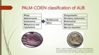 PALM-COIEN classification of AUB
Ryntz T, Lobo R. Chapter 26. Abnormal Uterine Bleeding;
In Comprehensive Gynecology 7th e...