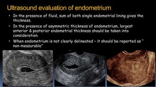 Ultrasound evaluation of endometrium
• In the presence of fluid, sum of both single endometrial lining gives the
thickness.
• In the presence of asymmetric thickness of endometrium, largest
anterior & posterior endometrial thickness should be taken into
consideration.
• When endometrium is not clearly delineated – it should be reported as “
non-measurable”
 