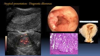 Atypicalpresentation- Diagnosticdilemmas
 