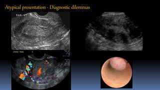 Atypical presentation - Diagnosticdilemmas
 