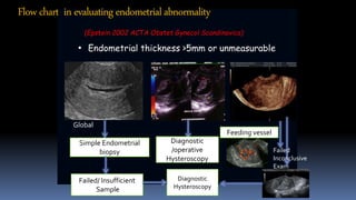 • Endometrial thickness >5mm or unmeasurable
Global
Simple Endometrial
biopsy
Failed/ Insufficient
Sample
Diagnostic
/operative
Hysteroscopy
Feeding vessel
Failed
Inconclusive
Exam
Diagnostic
Hysteroscopy
Flowchart in evaluatingendometrialabnormality
(Epstein 2002 ACTA Obstet Gynecol Scandinavica)
 
