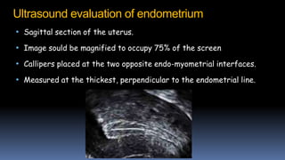 Ultrasound evaluation of endometrium
• Sagittal section of the uterus.
• Image sould be magnified to occupy 75% of the screen
• Callipers placed at the two opposite endo-myometrial interfaces.
• Measured at the thickest, perpendicular to the endometrial line.
 