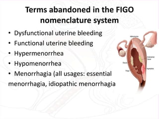 Terms abandoned in the FIGO
nomenclature system
• Dysfunctional uterine bleeding
• Functional uterine bleeding
• Hypermenorrhea
• Hypomenorrhea
• Menorrhagia (all usages: essential
menorrhagia, idiopathic menorrhagia,
 