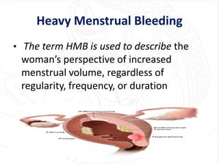Heavy Menstrual Bleeding
• The term HMB is used to describe the
woman’s perspective of increased
menstrual volume, regardless of
regularity, frequency, or duration
 