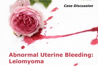 Powerpoint Templates
Page 1
Powerpoint Templates
Abnormal Uterine Bleeding:
Leiomyoma
Case Discussion
 