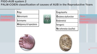 10
FIGO-AUB system 2
PALM-COIEN classification of causes of AUB in the Reproductive Years
Anatomic
causes
Non-
anatomic
causes
 