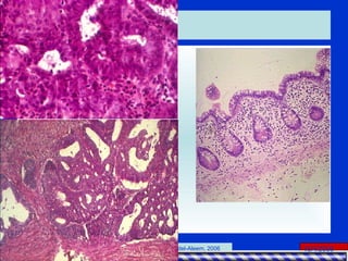 15/4/2006Dr. Mahmoud Abdel-Aleem, 2006
 