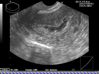 15/4/2006Dr. Mahmoud Abdel-Aleem, 2006
 