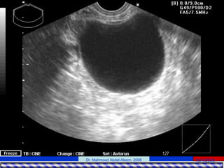 15/4/2006Dr. Mahmoud Abdel-Aleem, 2006
 