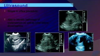 Ultrasound
 Simple in office procedure
 Able to identify pathology of
endometrium as well as other pelvic
abnormalities
 
