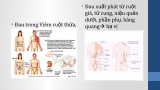 • Đau trong Viêm ru t th a,ộ ừ
NMCT
• Đau xu t phát t ru tấ ừ ộ
già, t cung, ni u qu nử ệ ả
d i, ph n ph , bàngướ ầ ụ
quang h vạ ị
 
