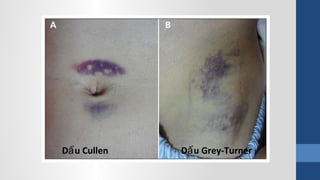 D u Cullenấ D u Grey-Turnerấ
 