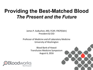 Providing the Best-Matched Blood
The Present and the Future
James P. AuBuchon, MD, FCAP, FRCP(Edin)
President & CEO
Professor of Medicine and of Laboratory Medicine
University of Washington
Blood Bank of Hawaii
Transfusion Medicine Symposium
August 6, 2016
 