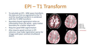 EPI – T1 Transform
• To calculate an EPI – MNI space transform,
the data are first co-registered to the T1
and the resulting transform is combined
with the T1-MNI transform
• Boundary based registration relies on
information from the white – grey matter
boundary for a better alignment
• Requires good WM segmentation
• Also requires good contrast in EPI
volumes, may make registration worse for
images with poor contrast (multiband
data?)
 