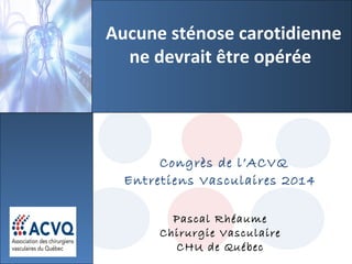 Congrès de l’ACVQ
Entretiens Vasculaires 2014
Pascal Rhéaume
Chirurgie Vasculaire
CHU de Québec
Aucune sténose carotidienne
ne devrait être opérée
 
