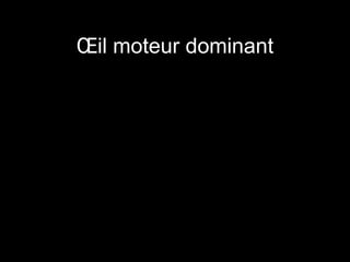 OEil moteur dominant 
 