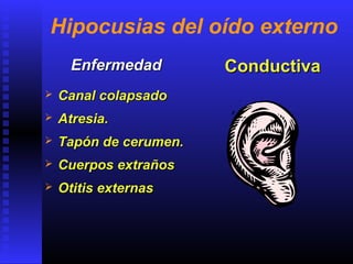 Hipocusias del oído externo
EnfermedadEnfermedad
 Canal colapsadoCanal colapsado
 Atresia.Atresia.
 Tapón de cerumen.Tapón de cerumen.
 Cuerpos extrañosCuerpos extraños
 Otitis externasOtitis externas
ConductivaConductiva
 