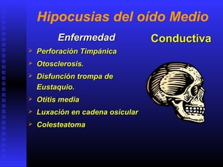 Hipocusias del oído Medio
EnfermedadEnfermedad
 Perforación TimpánicaPerforación Timpánica
 Otosclerosis.Otosclerosis.
 Disfunción trompa deDisfunción trompa de
Eustaquio.Eustaquio.
 Otitis mediaOtitis media
 Luxación en cadena osicularLuxación en cadena osicular
 ColesteatomaColesteatoma
ConductivaConductiva
 