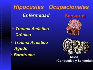 Hipocusias Ocupacionales
EnfermedadEnfermedad
 Trauma AcústicoTrauma Acústico
CrónicoCrónico
SensorialSensorial
 Trauma AcústicoTrauma Acústico
AgudoAgudo
 BarotrumaBarotruma Mixta
(Conductiva y Sensorial)
 