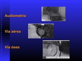 AudiometríaAudiometría
Vía aéreaVía aérea
Vía óseaVía ósea
 