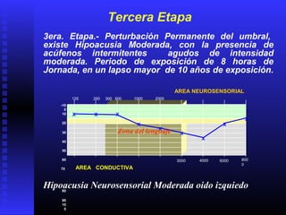 125 250 500 1000 2000
4000 800
0
3000 6000
-10
0
10
20
30
40
50
60
70
80
90
10
0
AREA CONDUCTIVA
AREA NEUROSENSORIAL
Tercera Etapa
3era. Etapa.- Perturbación Permanente del umbral,
existe Hipoacusia Moderada, con la presencia de
acúfenos intermitentes agudos de intensidad
moderada. Periodo de exposición de 8 horas de
Jornada, en un lapso mayor de 10 años de exposición.
X X X
X
X
X
X
X
X
300
Zona del lenguaje
Hipoacusia Neurosensorial Moderada oido izquiedo
 