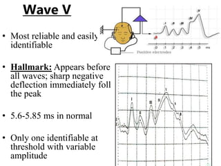 Wave V
• Most reliable and easily
identifiable
• Hallmark: Appears before
all waves; sharp negative
deflection immediately foll
the peak
• 5.6-5.85 ms in normal
• Only one identifiable at
threshold with variable
amplitude
 
