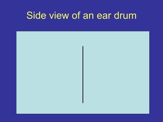 Side view of an ear drum
 