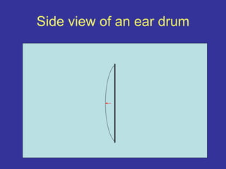 Side view of an ear drum
 