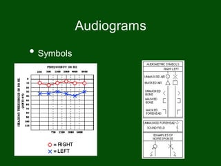 • Symbols
Audiograms
 