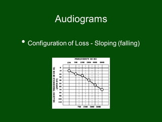 • Configuration of Loss - Sloping (falling)
Audiograms
 
