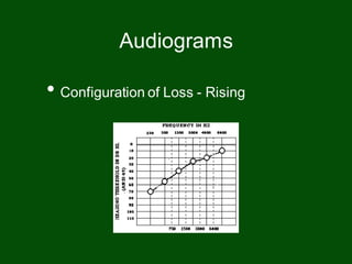 • Configuration of Loss - Rising
Audiograms
 