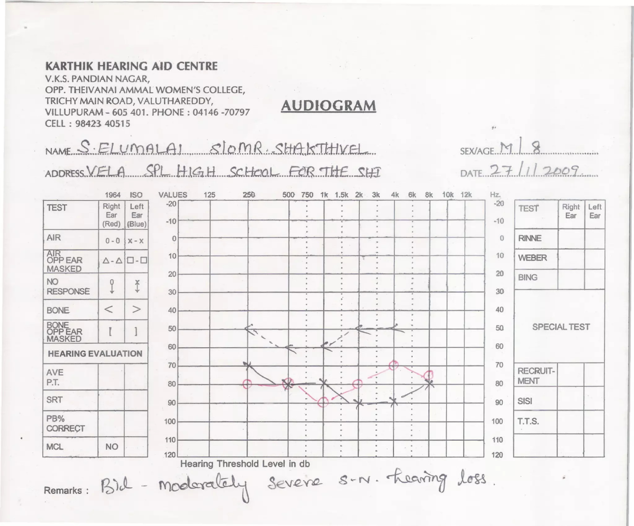 Audiogram 7 children | PDF