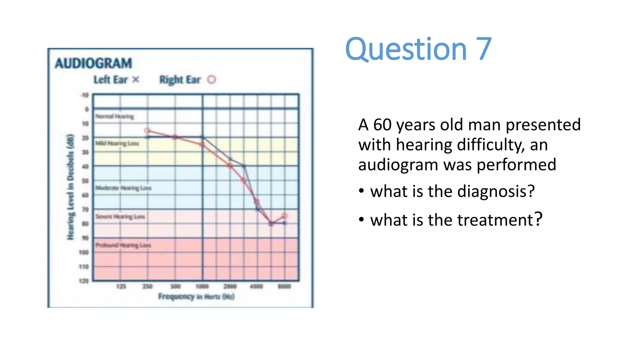 Audiogram and Tympanogram-Dr.Bagasi.pptx