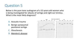Below is the pure tone audiogram of a 52-years-old women who
is being investigated for attacks of vertigo and right ear tinnitus.
What is the most likely diagnosis?
A. Acoustic trauma
B. Benign paroxysmal
positional vertigo
C. Otosclerosis
D. Meniére’s disease
Question 5
 