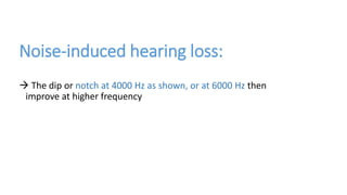 Noise-induced hearing loss:
 The dip or notch at 4000 Hz as shown, or at 6000 Hz then
improve at higher frequency
 