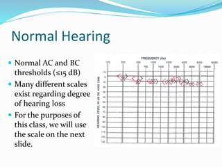 Audiogram Interpretation PPTX Audiogram Interpretation PPTX