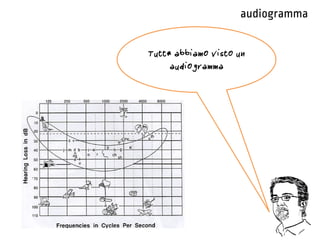 audiogramma
Tutt* abbiamo visto un
audiogramma
 