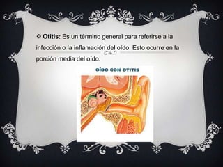  Otitis: Es un término general para referirse a la

infección o la inflamación del oído. Esto ocurre en la
porción media del oído.

 