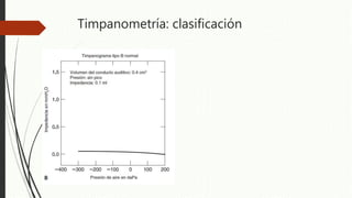 Timpanometría: clasificación
 