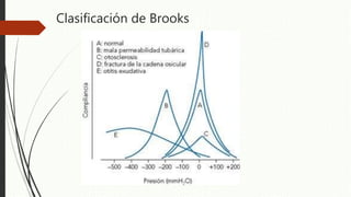 Clasificación de Brooks
 