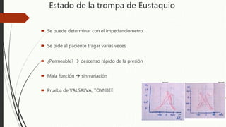 Estado de la trompa de Eustaquio
 Se puede determinar con el impedanciometro
 Se pide al paciente tragar varias veces
 ¿Permeable?  descenso rápido de la presión
 Mala función  sin variación
 Prueba de VALSALVA, TOYNBEE
 